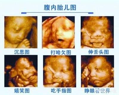 24周胎儿长什么格式？